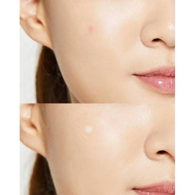 COSRX Acne Pimple Master Patch hidrokoloidiniai pleistrai nuo spuogų, 24 vnt.